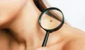 2026: Cancerul de piele poate fi prevenit! Fii în siguranță la soare! Testează-te gratuit!