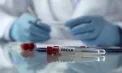 Un caz de ebola a fost înregistrat în premieră în Franţa. Un medic întors din RD Congo a fost testat pozitiv