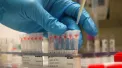 32 de persoane s-au îmbolnăvit după un eveniment privat organizat la Florești. Salmonella, depistată la șase dintre participanți
