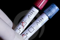Disperare fara limite in Grecia. Oamenii se expun intentionat la HIV pentru ajutoare de stat