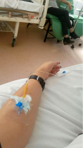 Incep testele pe oameni pentru vaccinul anticancer. Ce efecte a avut asupra animalelor