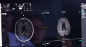 O echipa formata din 30 medici, invinsa de inteligenta artificiala. Sarcina primita