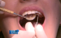 Fumatul poate duce la distrugerea lucrarilor dentare. Ce recomanda stomatologii
