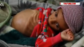 Yemenul ar putea fi afectat de cea mai mare foamete din ultimii o suta de ani, daca razboiul civil din aceasta tara nu va lua sfarsit - VIDEO