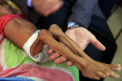 Fetita devenita simbol pentru razboiul din Yemen a murit. "Inima mi-e franta" - FOTO