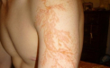 Pare un tatuaj, insa nu ti-ar trece niciodata prin minte ce este in realitate acest "desen"