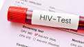 Al doilea om din lume care scapa de virusul HIV. Anuntul unei echipe de cercetatori