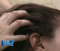 Tratamentele pe care le putem urma impotriva caderii parului
