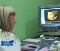 Care este cea mai frecventa tumora benigna in randul femeilor si ce trebuie sa faceti pentru a o diagnostica