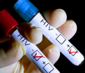 Rusia sustine ca ar avea aproape gata vaccinul impotriva HIV. O saptamana in urma il facusera si pe cel pentru Ebola