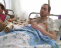 Un barbat din capitala, STRIVIT de lift. A venit la spital cu mana in punga, iar medicii i-au pus-o la loc