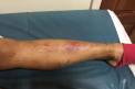 Rapiti de canibali. Un barbat si iubita lui au fost dezbracati, batuti si torturati de un trib din Papua Noua Guinee