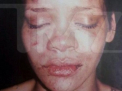Rihanna s-a impacat cu cel care a batut-o crunt? Chris Brown, cu pantalonii in vine -FOTO