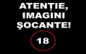 IMAGINI SOCANTE. O fetita de 4 ani a supravietuit miraculos dupa ce i-a intrat o surubelnita in fata