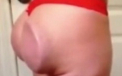 A mers la doctor sperand un posterior de model. "Si-a batut joc de mine. M-a mutilat". VIDEO