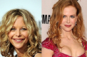 Nicole Kidman, deformata de operatiile estetice. Ce alte vedete de la Hollywood sunt de NERECUNOSCUT