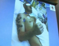 A primit o fata noua, la doar trei luni dupa ce i-a fost desfigurat craniul! E primul asemenea transplant