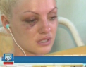 "Nu mai pot sa tac". Drama cumplita traita de Alexandra Stan: Ranile ar putea fi serioase