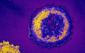 Serie misterioasa de decese in Canada, in urma unei epidemii de enterovirus intr-un azil de batrani