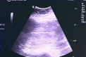 Uterul in chirie: "Noi va dam banii, iar dumneavoastra copilul". Cat costa o mama suragat in Moldova