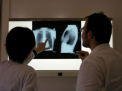 Tuberculoza face ravagii in scoli. Inca 16 copii din Falesti, INFECTATI. Autoritatile: "Este grav"
