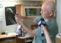 A venit la spital cu mana in punga, iar medicii au reusit sa i-o puna la loc! Caz incredibil la Chisinau
