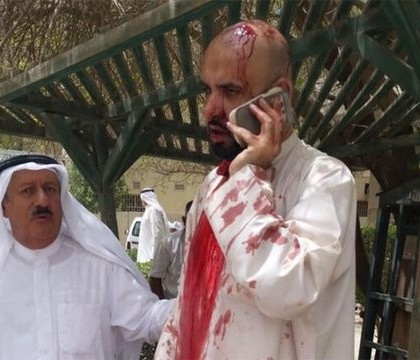 Atentat sinucigas al Statului Islamic, la o moschee din Kuweit, in timp ce oamenii se rugau. Sunt cel putin 13 morti Atentat sinucigas al Statului Islamic, la o moschee din Kuweit, in timp ce oamenii se rugau. Sunt cel putin 13 morti