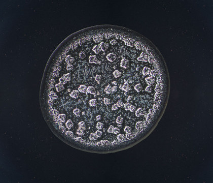 Cum arata lacrimile noastre la microscop. Ce a observat un fotograf este de-a dreptul impresionant Cum arata lacrimile noastre la microscop. Ce a observat un fotograf este de-a dreptul impresionant