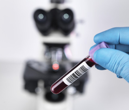 Premiera medicala. O tanara din Franta, infectata cu HIV la nastere, in remisiune desi nu a primit tratament 12 ani Premiera medicala. O tanara din Franta, infectata cu HIV la nastere, in remisiune desi nu a primit tratament 12 ani