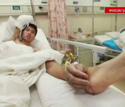 Operatie uluitoare in China. Motivul pentru care medicii i-au transplantat unui barbat mana pe picior