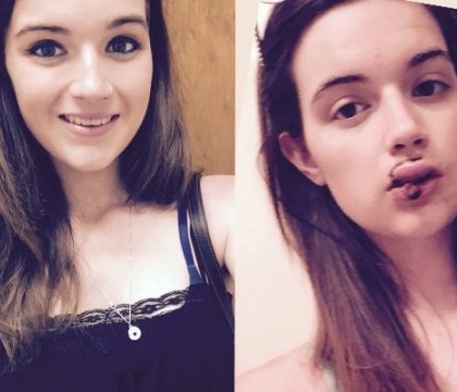 O tanara de 17 ani din Louisiana, atacata de mai multi barbati. Motivul incredibil pentru care au lasat-o desfigurata O tanara de 17 ani din Louisiana, atacata de mai multi barbati. Motivul incredibil pentru care au lasat-o desfigurata