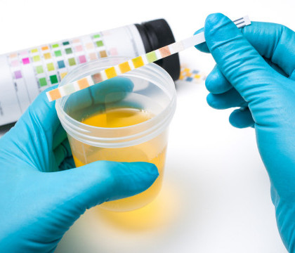 Analiza banala care detecteaza cea mai agresiva forma de cancer. Descoperirea care poate salva mii de vieti