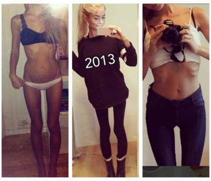 La 17 ani a devenit anorexica din cauza unei depresii. Cum arata acum tanara care se mandreste cu formele ei pe Instagram
