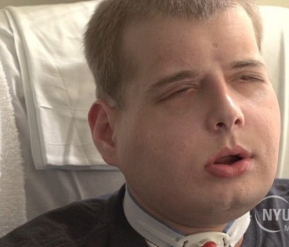 Cel mai scump transplant de fata din lume: a costat 1 milion de dolari. Un pompier a primit "chipul" unui tanar de 26 de ani - FOTO