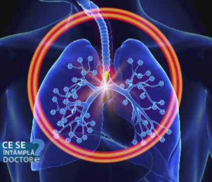 Poluarea casnica, una dintre cauzele aparitiei bolilor pulmonare cronice. Cum explica medicii legatura