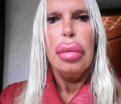 A cheltuit 52.000 de lire ca sa fie "perfecta". Cum a ajuns sa arate o transsexuala depedenta de operatii estetice A cheltuit 52.000 de lire ca sa fie "perfecta". Cum a ajuns sa arate o transsexuala depedenta de operatii estetice