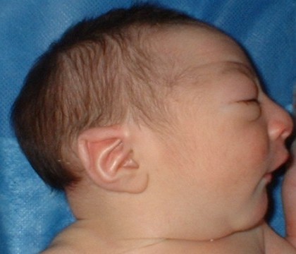 Alerta in SUA, dupa ce un bebelus s-a nascut cu capul anormal de mic. Virusul periculos pe care l-a adus mama sa din Brazilia Alerta in SUA, dupa ce un bebelus s-a nascut cu capul anormal de mic. Virusul periculos pe care l-a adus mama sa din Brazilia