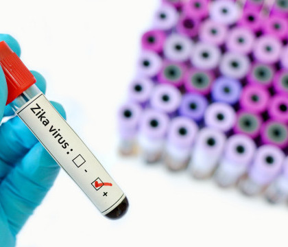Primul caz de Zika in Europa. Pacienta a revenit din Columbia si e gravida in 3 luni Primul caz de Zika in Europa. Pacienta a revenit din Columbia si e gravida in 3 luni