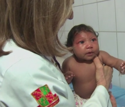 Legatura dintre virusul Zika si microcefalie, confirmata de cercetatori. Ce alte afectiuni extrem de grave poate provoca Legatura dintre virusul Zika si microcefalie, confirmata de cercetatori. Ce alte afectiuni extrem de grave poate provoca