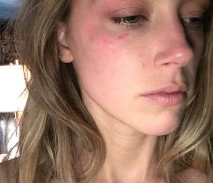 Amber Heard a cerut ordin de restrictie pentru Johnny Depp. Actrita sustine ca a fost batuta de acesta Amber Heard a cerut ordin de restrictie pentru Johnny Depp. Actrita sustine ca a fost batuta de acesta