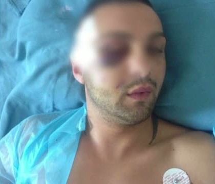 Luptator de kickboxing din Timisoara, batut cu bestialitate de mai multi indivizi. Totul s-a intamplat in prezenta iubitei