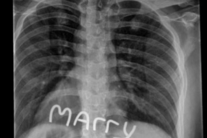 Ideea unui american: cum sa-ti ceri in casatorie iubita, medic radiolog