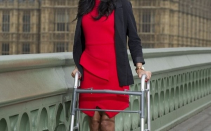 Modelul care a ramas fara un picior dupa un accident le motiveaza pe tinerele din Marea Britanie Modelul care a ramas fara un picior dupa un accident le motiveaza pe tinerele din Marea Britanie
