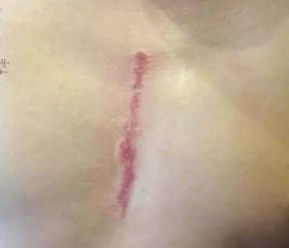 Gestul emotionant facut de un tata pentru fiul sau, suparat ca va ramane cu o cicatrice dupa ce a fost operat