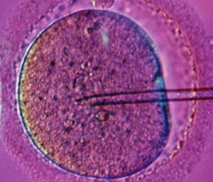 Cercetatorii au demontat o teorie veche de 200 de ani. Cum ar putea "crea copii" fara material genetic feminin Cercetatorii au demontat o teorie veche de 200 de ani. Cum ar putea "crea copii" fara material genetic feminin