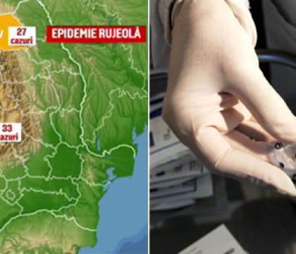 Stare de alerta in Romania: a fost declarata EPIDEMIE de rujeola, dupa moartea a 3 copii. Cauza oficiala: campaniile anti-vaccinare Stare de alerta in Romania: a fost declarata EPIDEMIE de rujeola, dupa moartea a 3 copii. Cauza oficiala: campaniile anti-vaccinare