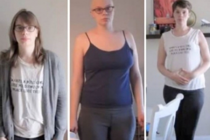 O tanara bolnava de cancer s-a fotografiat in fiecare saptamana timp de un an O tanara bolnava de cancer s-a fotografiat in fiecare saptamana timp de un an
