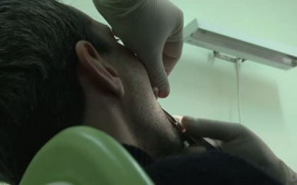 Cum arata barbatul care nu a fost niciodata la dentist. Credea ca e normal sa aiba asa ceva in gura Cum arata barbatul care nu a fost niciodata la dentist. Credea ca e normal sa aiba asa ceva in gura