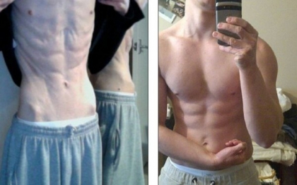 Manca doar o banana si un baton de cereale pe zi. A invins anorexia si a ajuns model