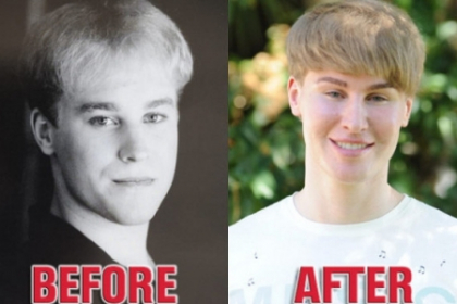 Un barbat de 33 de ani a dat 100.000 de dolari pe operatii pentru a arata ca Justin Bieber